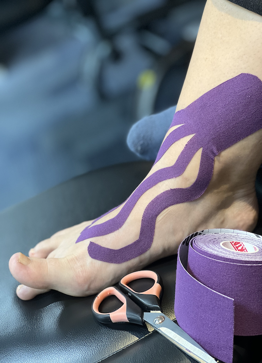 Quadriceps Tendonitis Kinesio Taping